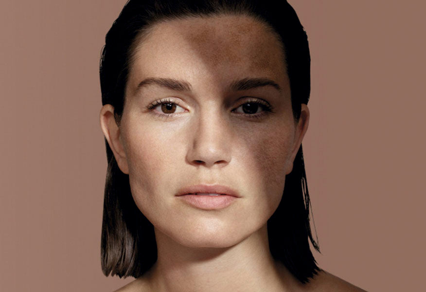 Cosmelan ārstēšana