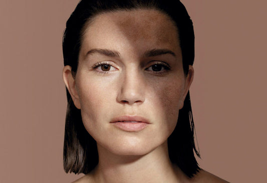 Cosmelan treatment